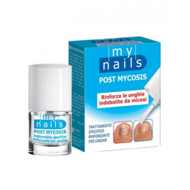 Postmykose My Nails 5ml