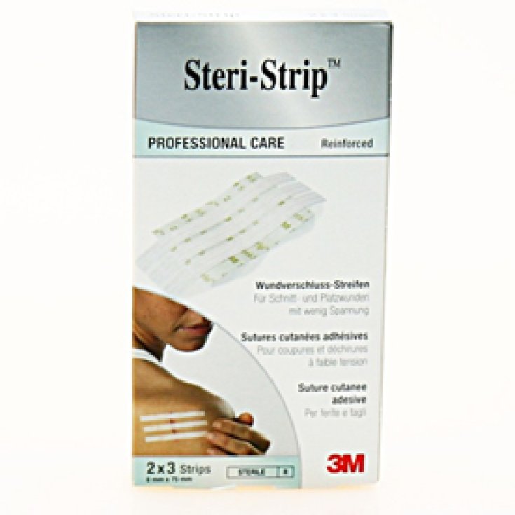 Steristrip 3m 6x75mm 6St