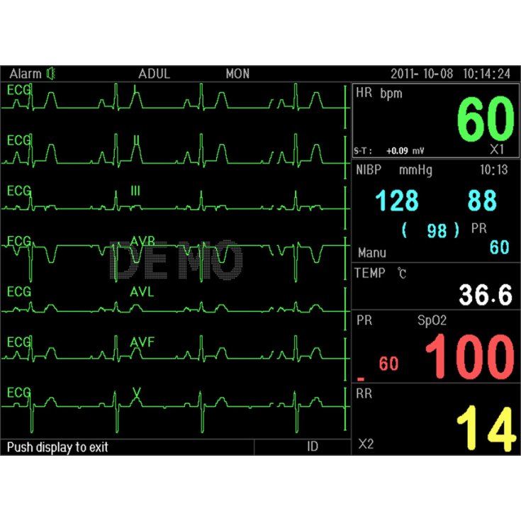 P16 PC3000 MULTIPARAM-MONITOR